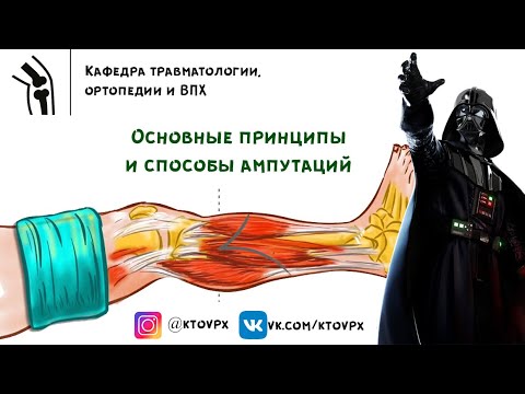 Основные принципы и виды ампутаций | Травматология и ортопедия