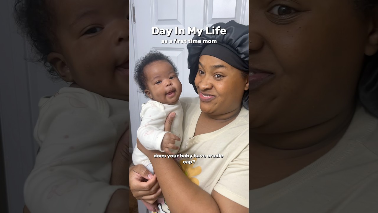 Does your baby have cradle cap? 👶🏽🧴✨ 