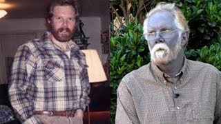 【衝撃】世界の奇妙な病気が恐ろしすぎる・・・ 狼男症候群 検索動画17 【衝撃】世界の奇妙な病気が恐ろしすぎる・・・ 狼男症候群 検索動画 17