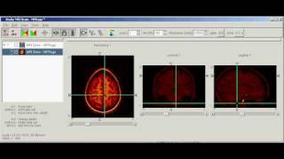AMIDE 3D Imaging Software screenshot 3