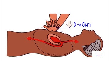 Huấn luyện an toàn điện Bài 10: Phương pháp hà hơi thổi ngạt kết hợp ép tim ngoài lồng ngực