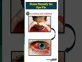 Eye Flu 5 Home Remedies Eyeflu Pinkeye Redeye Conjunctivitis