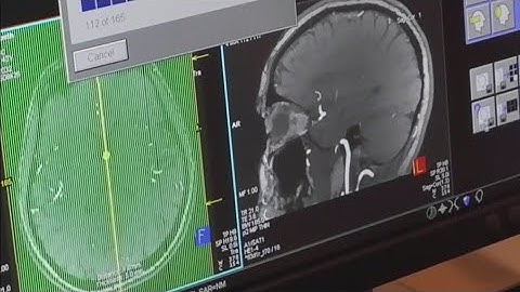 Explaining COVID ‘brain fog’