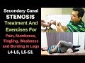 Spinal stenosis L4-L5,L5-S1, Foraminal stenosis, Spinal Stenosis treatment, spine stenosis exercises
