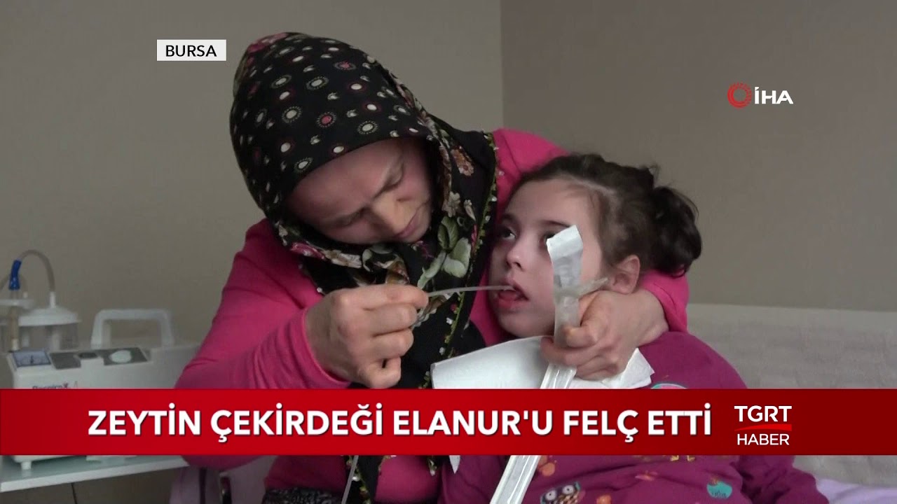 Boğazına Kaçan Zeytin Çekirdeği Elanur'u Felç Etti