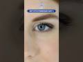 How to Prevent and Treat Dry Eyes Naturally | Eye Care Tips by Dr. Niharika Khute #ophthalmologists