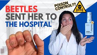 Beetles Sent a Licensed Pro to the ER 🚑 Poison Control Aware?!