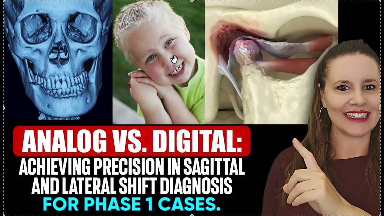 Analog vs Digital Methods of Diagnosing and Treatment Planning for CRCO Shifts Phase 1 Interceptive
