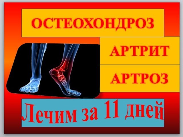 najnoviji tretmani za artritis i artrozu simptomi i liječenje artroze podlaktice