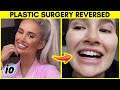 Top 5 Influencers That Reversed Their Plastic Surgery