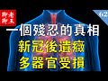 COVID-19   一個殘忍的真相-------新冠后遺症多器官受損 | |New coronavirus complications