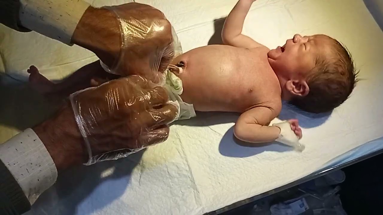 How to Pass Glycerin Suppository for Abdominal Distension in Newborn | Step-by-Step Guide