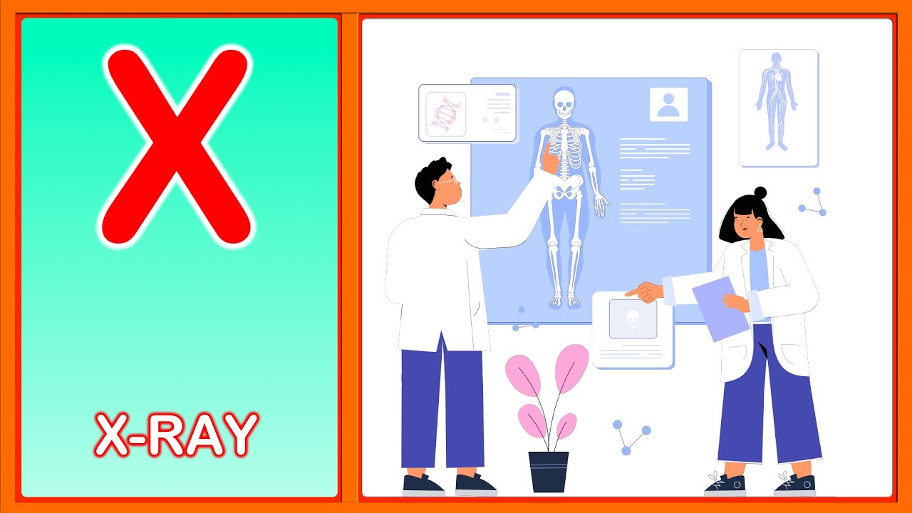 The X Song | Super Phonics | Capital letter X - YouTube