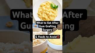 Just Had Gum Surgery? Here's What You CAN & CAN'T Eat!  |  District Dental Surgery screenshot 5