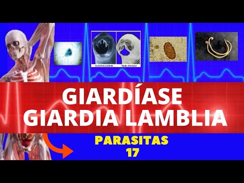 Vídeo: Paralelos Múltiplos Do α-SNAP Em Giardia Lamblia Exibem Localização E Redistribuição Subcelular Independente Durante A Cistação E O Estresse