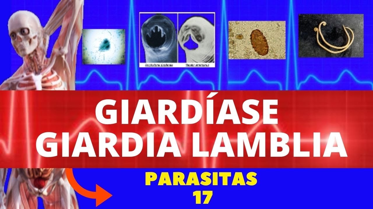 papiloamele de pe papa sunt îndepărtate instrumente de prevenire a viermilor pentru copii