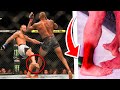 TERRIFYING Leg Kicks That Caused Legs To FAIL...