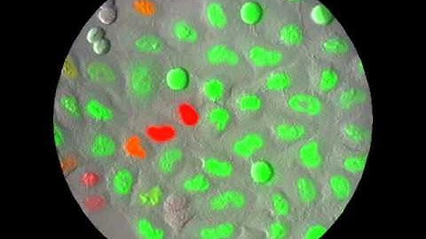 Time-Lapse Imaging of Fucci-Expressing HeLa Cells