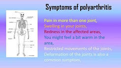 What is Polyarthritis, Symptoms and Treatment - Hoool.com