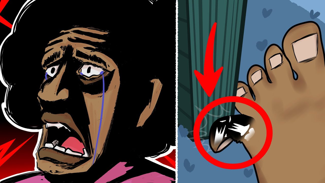 اكثر الأصابات المؤلمة يلي جاتني 🤕