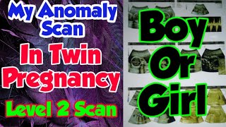 My Anomaly/Level-2 Scan in Twin Pregnancy !! Boys or Girls ??