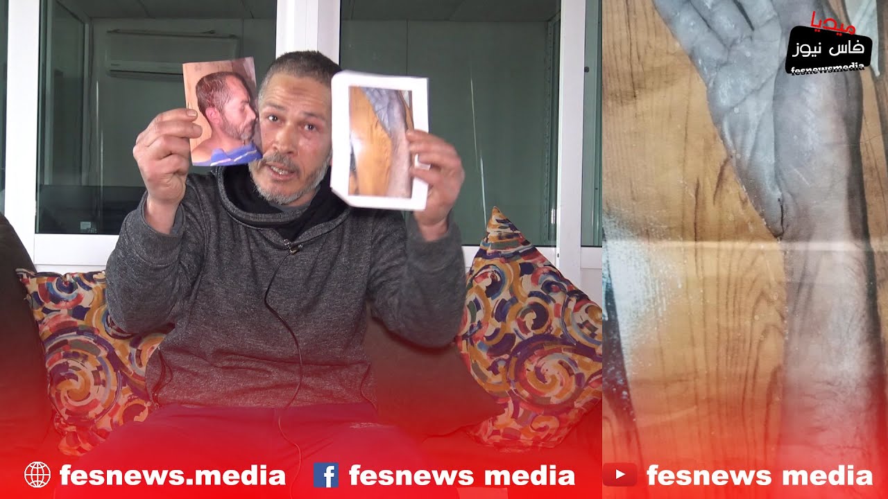 شقيق معتقل توفى داخل السجن بفاس بغينا  فيديو كاميرات المراقبة واش خرجوه من البيت  صحيح أو مغمى عليه