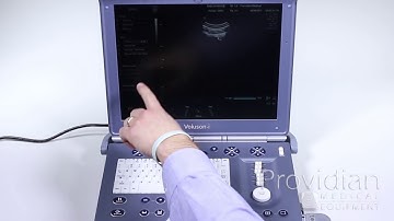 GE Voluson i Training Part 6: System Setup and DICOM