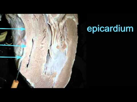 AP2 HEART ANATOMY QUIZ: EPICARDIUM - YouTube