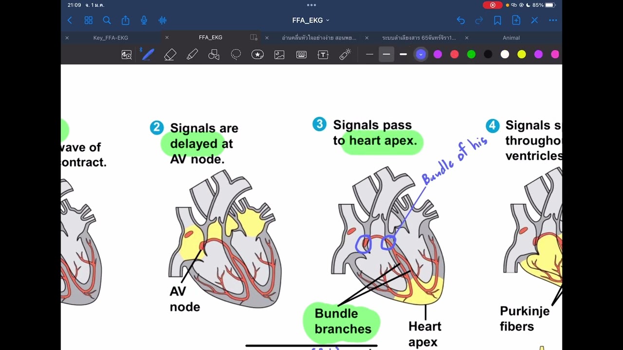 EKG อ่านกราฟคลื่นกระแสไฟฟ้าหัวใจ เบื้องต้นสำหรับน้อง ม.5