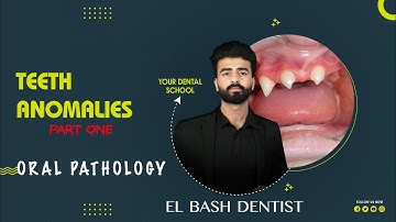 developmental anomalies || teeth anomalies 1|| oral pathology _عزت شومان