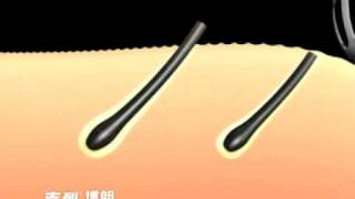 Gillette Braun Prosonic TVC