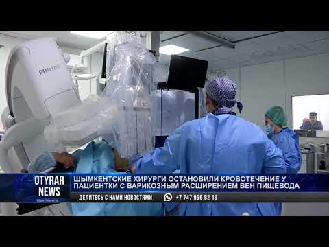 Шымкентские хирурги остановили кровотечение у пациентки с варикозным расширением вен пищевода