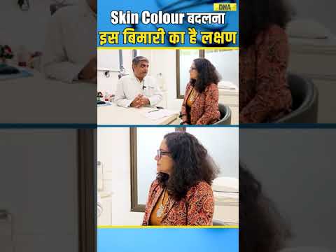 "Uncovering the Causes of Pigmentation! 🌟"