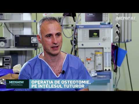 Video: Efectul Osteotomiei Tibiale Ridicate Medial Cu Pană Deschisă Asupra Articulației Patelofemorale: Analiză Comparativă în Funcție De Starea Cartilajului Preexistentă