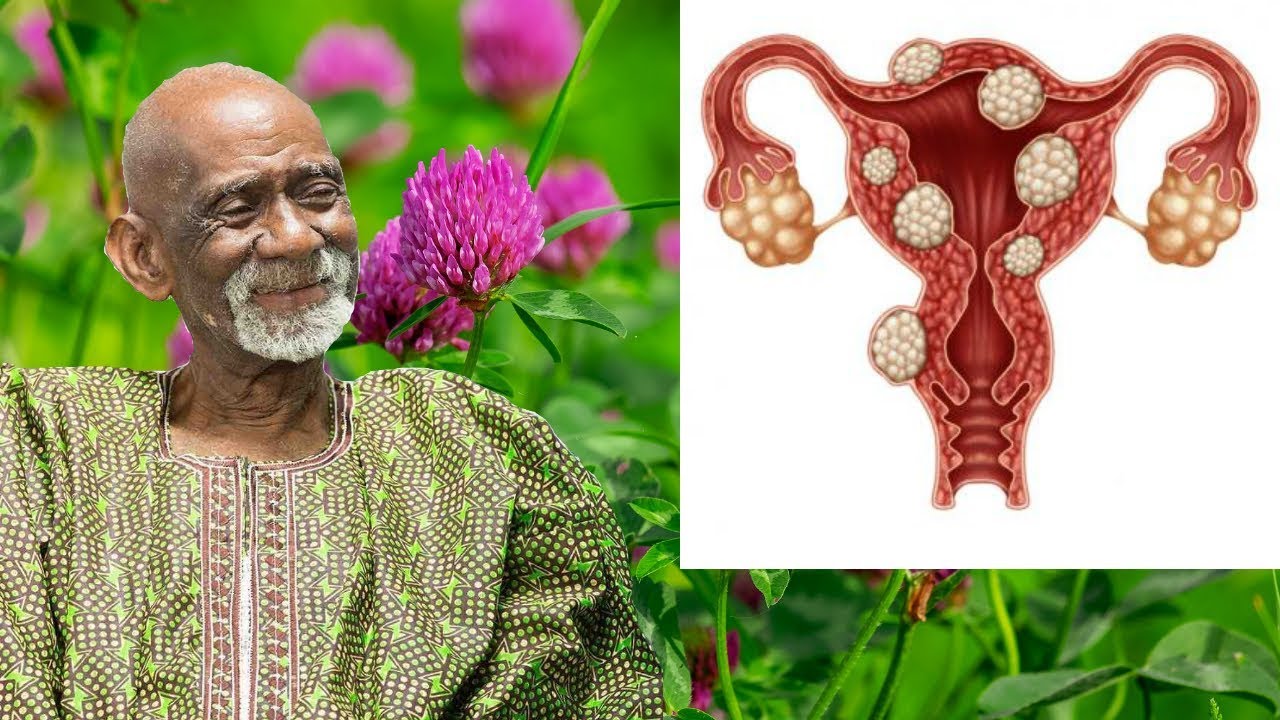natural numbers Dr Sebi - Red Clover Natural Remedy For Uterus Endometriosis