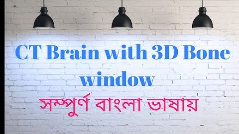 CT Scan of brain with 3D Bone window