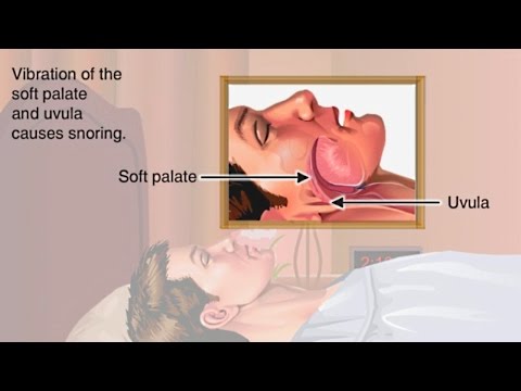 Snoring affects many of people during their sleep. often, do not even realize they are snoring. let’s turn on the lights and see where is ...