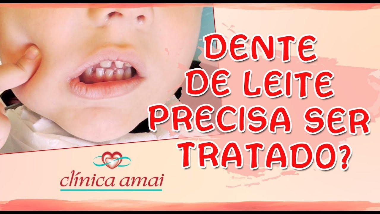 Carie Em Bebes E Criancas