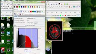 MIPAV Basics Display Options.avi
