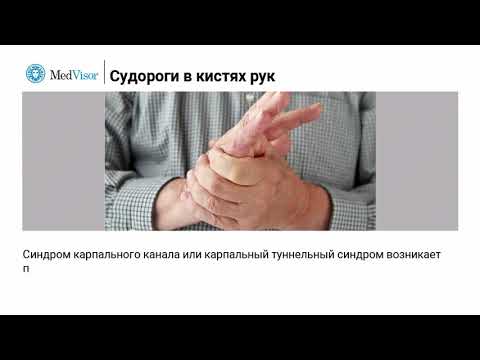 Судороги в кистях руки: причины