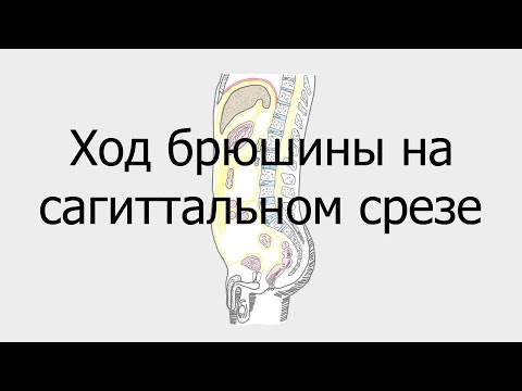 Ход брюшины