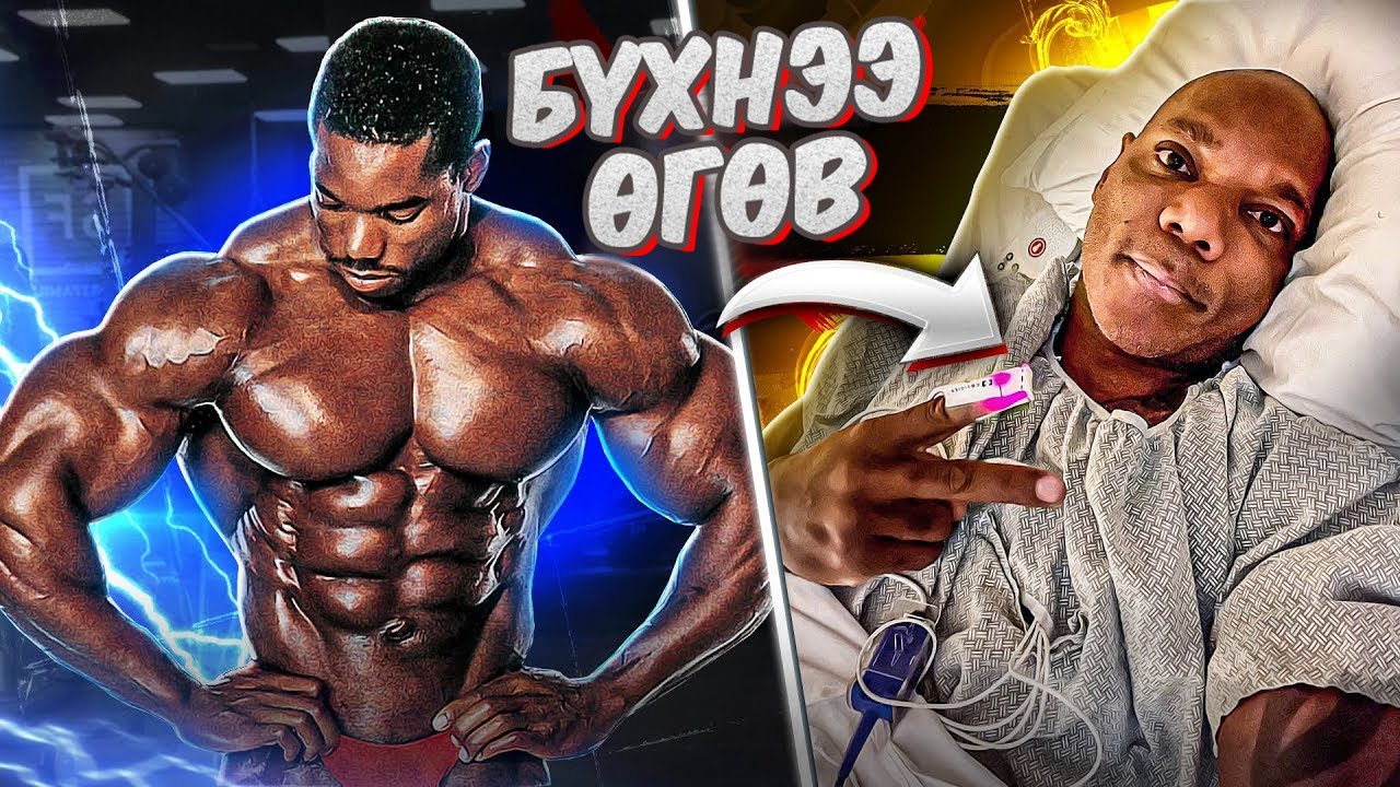 Домогт #Flex_Wheeler яагаад хөлөө тайруулсан бэ? Түүний алдаа...