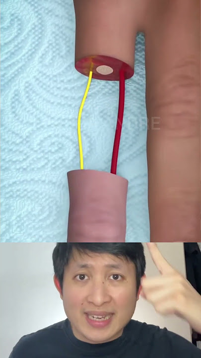 GAK NYANGKA JARI TANGAN PUTUS BISA DISAMBUNG LAGI ?! | Yosua Andre #shorts #facts #tipsandtricks