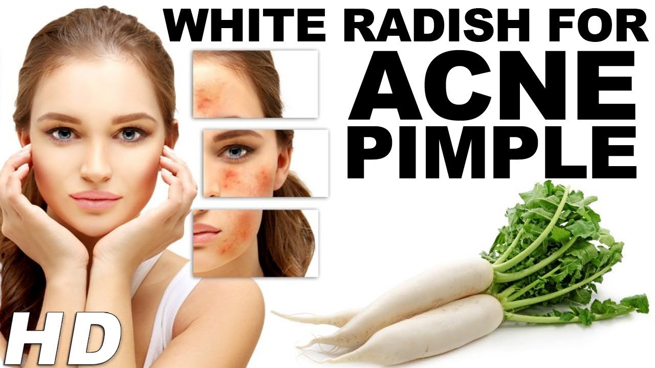 White Radish For Acne PimpleBenefits Of Radish Juice For Skin In Hindi