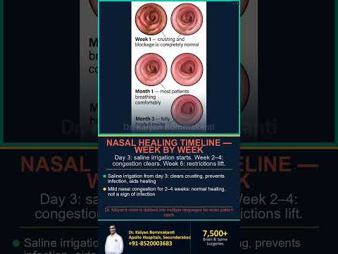 Nasal Care After Pituitary Surgery - Best Endoscopic Pituitary Surgery, Hyderabad | తెలుగు