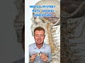 Deemed a medical mystery