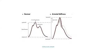 Invasive hemodynamics, Dr. Hatim Kherallah, 19/7/2022