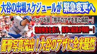 🔴🔴【大谷翔平】まさかの負傷で戦線離脱！精密検査を受け、衝撃の結果が判明…！ベッツが涙「翔平のアザを見て胸が締めつけられた」衝撃写真流出で波紋！大谷の出場計画が変更、大谷驚愕「冗談だろ？」