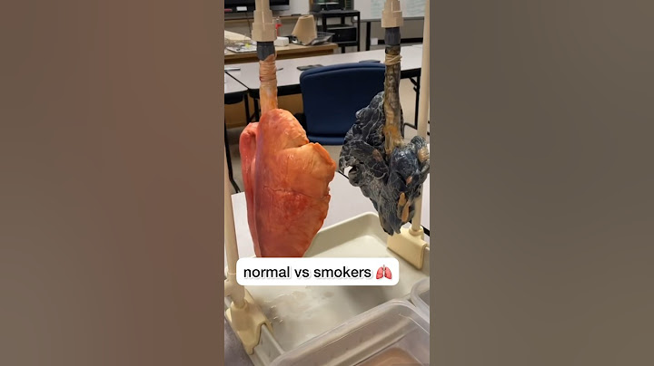 How smokers lungs look like