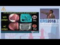 Ers london 2018 the role of bitter taste receptors in predicting outcomes in crs noam cohen